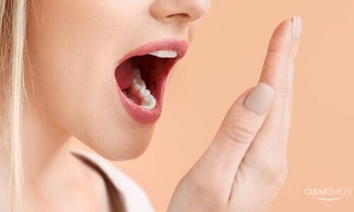 How to fight off bad breath and halitosis