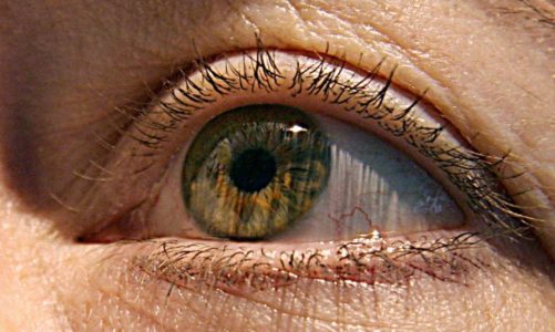 Alzheimer’s disease first signs may appear in your eyes, study finds