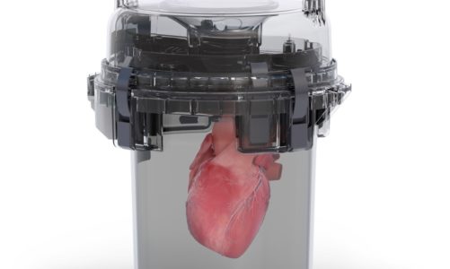 Boston doctors perform historic heart transplant after the organ was transported 2,506 miles from Alaska: ‘Monumental case’