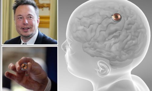 FDA approves Elon Musk’s Neuralink implants for humans test
